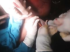 Real Vagina Surgery   Intrauterine Catheter