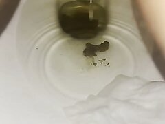 18 Year Old Pooping Toilet View