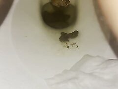 18 Year Old Pooping Toilet View