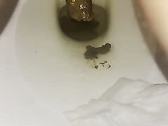 18 Year Old Pooping Toilet View